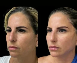 permanent threads miami 22 Permanent Threads miami