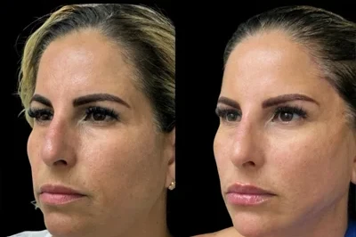 Permanent Threads miami