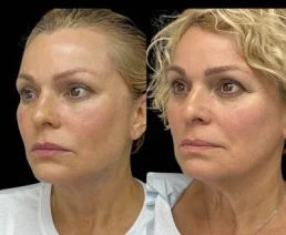 permanent threads miami 21 Permanent Threads miami