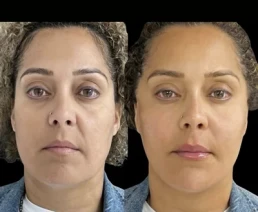 permanent threads miami 20 Permanent Threads miami