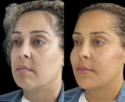 permanent threads miami 19 Permanent Threads miami