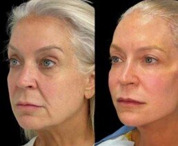 Permanent Threads miami