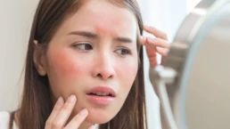 Can You Be Allergic to Botox