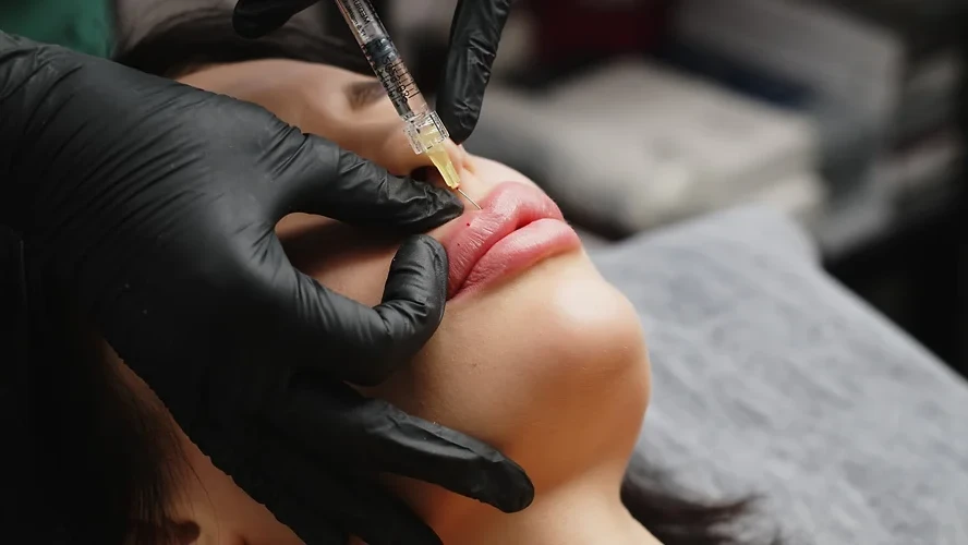 How Much Do Lip Fillers Cost in Miami