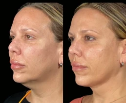 permanent threads miami 02 18 Permanent Threads miami 02