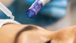 how to treat breakouts after microneedling? 7 How to Treat Breakouts After Microneedling