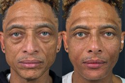 facial balancing west palm beach 57 Facial Balancing west palm beach