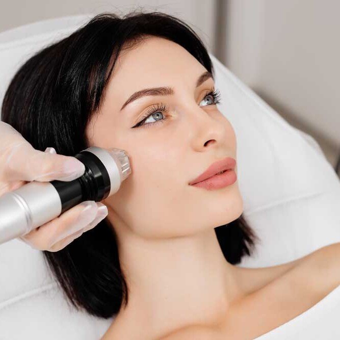 rf microneedling sylfirm x redlands ca uai