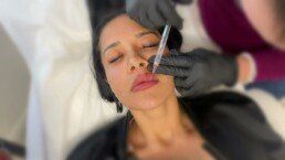 facial balancing: making the switch 22 facial balancing making the switch uai